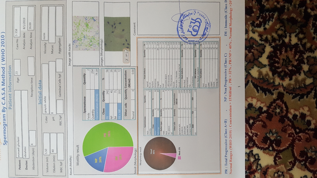 تفسیر آزمایش اسپرم همسرم