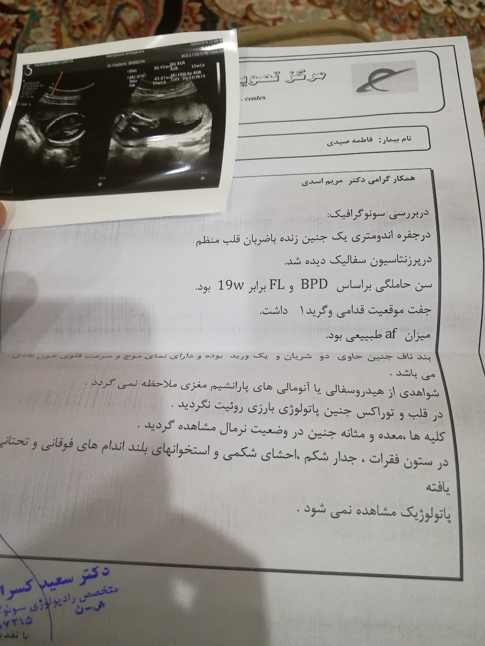 سونوگرافی آنومالی در هفته 19