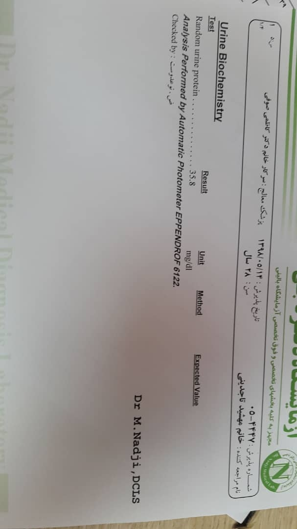 عدد دفع پروتعین رندومم نرماله؟