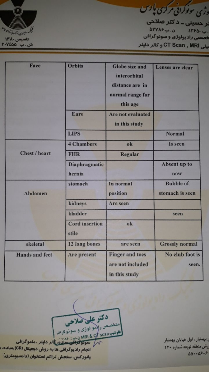 جواب سونوی انومالی رو ببینین