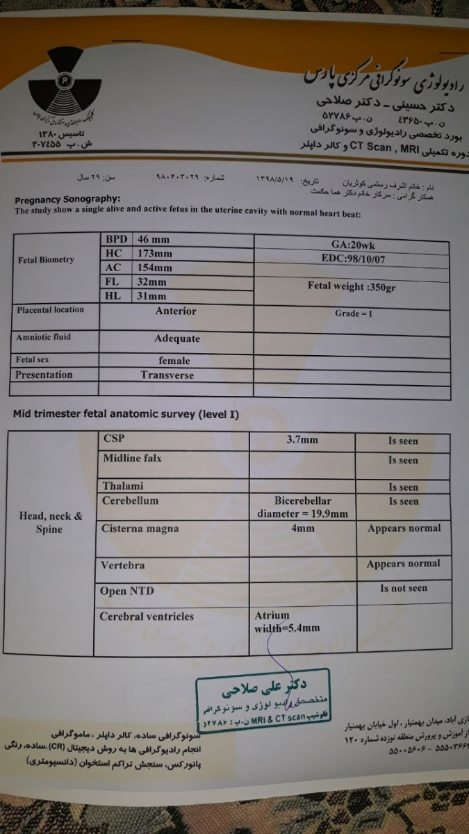 جواب سونوی انومالی رو ببینین