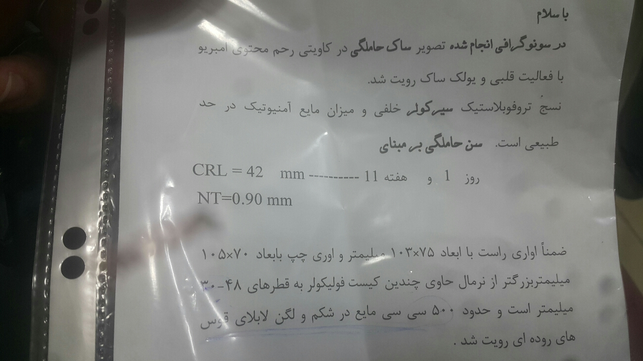 کیست های فولیکولر کیست های فولیکولر