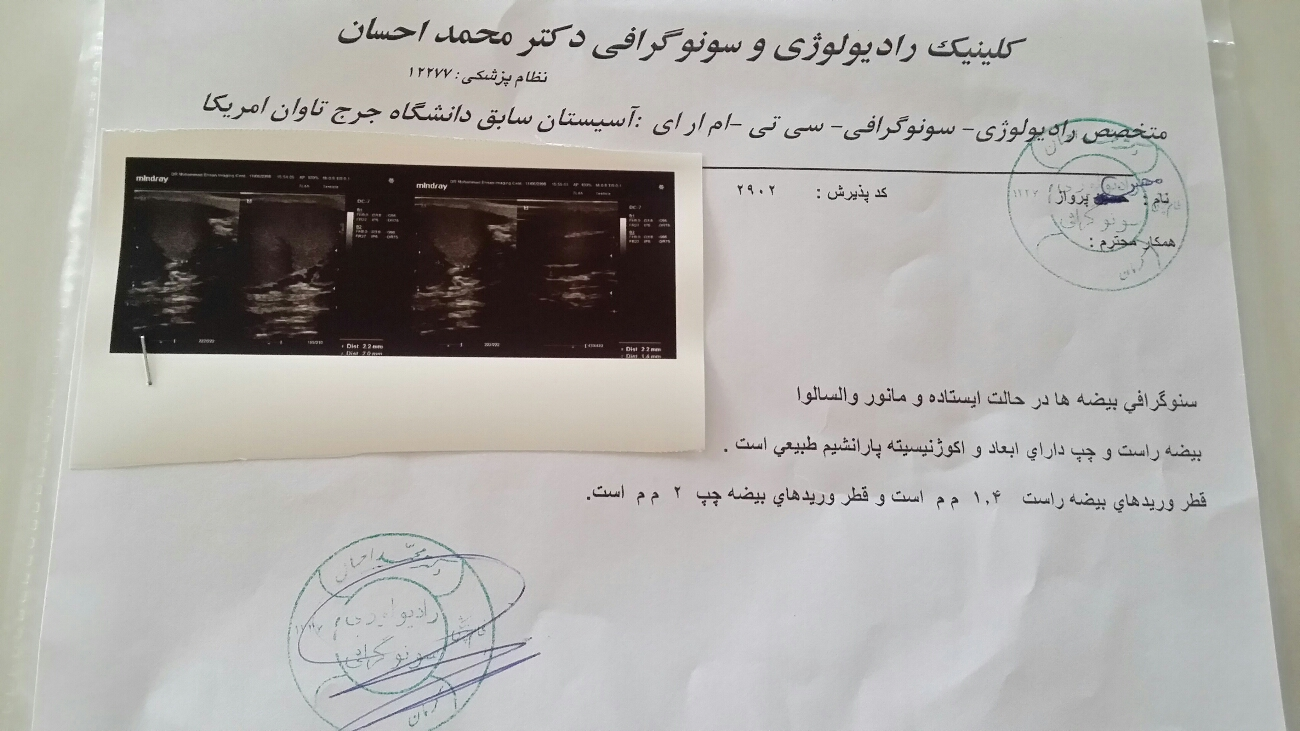 تفسیر سونو همسرم دکتر گفتن واریکسل دارن باید عمل کنن اما همسرم نمیخواد عمل کنه ایا راهی جز عمل وجود داره کسی میدونه راهنمایی کنه تفسیر سونو همسرم دکتر گفتن واریکسل دارن باید عمل کنن اما همسرم نمیخواد عمل کنه ایا راهی جز عمل وجود داره کسی میدونه راهنمایی کنه