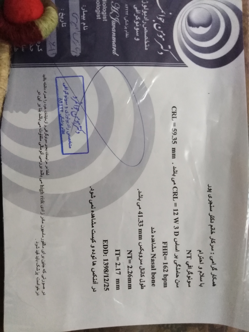 سونو ان تی لطفا کمک کنید سونو ان تی لطفا کمک کنید