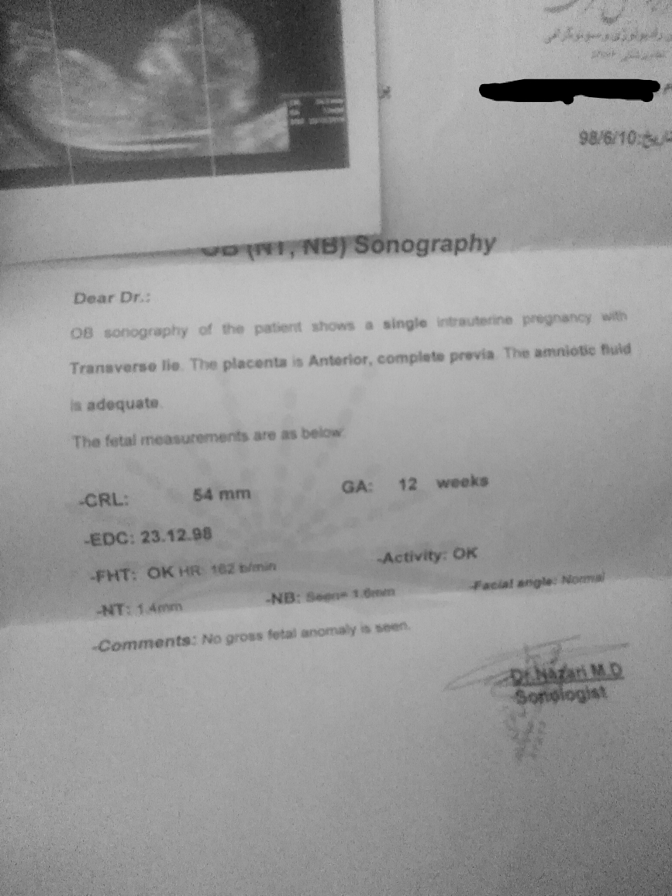 جفت قدامی سونو ان تی جفت قدامی سونو ان تی