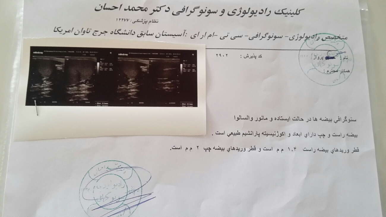 چند درصدد امکان بارداری با حرکت اسپرم کند هست؟ چند درصدد امکان بارداری با حرکت اسپرم کند هست؟