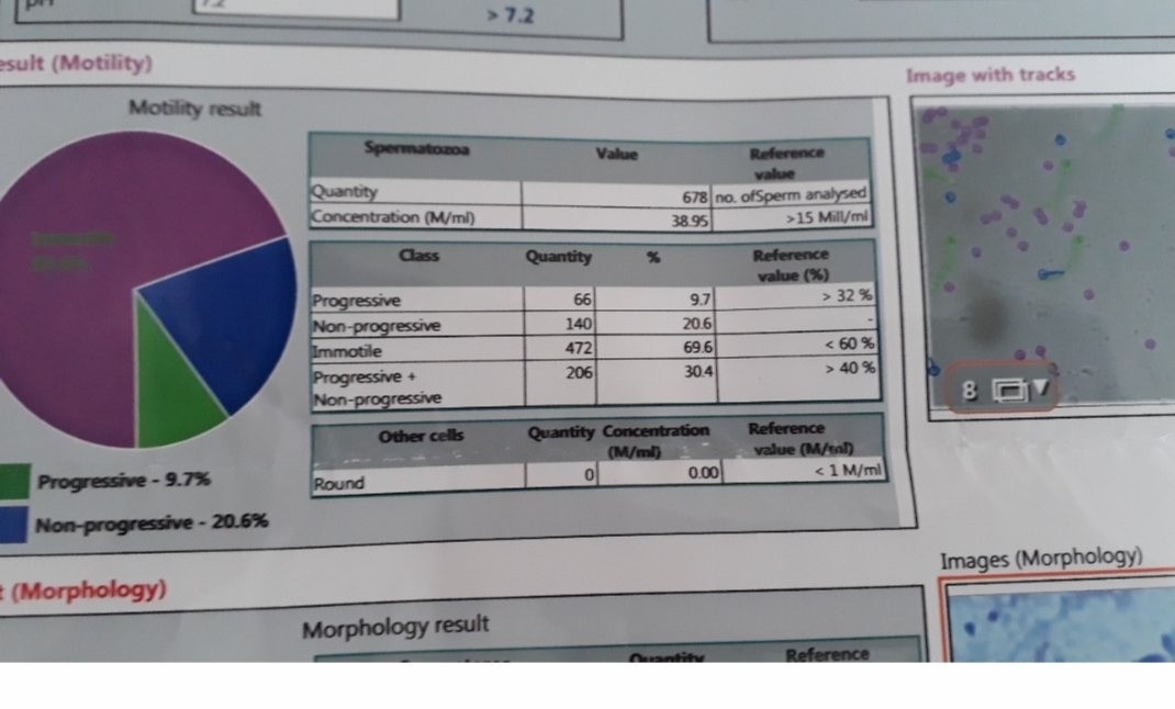 کدوم گزینه تو آزمایش همسرم مشکل داره؟