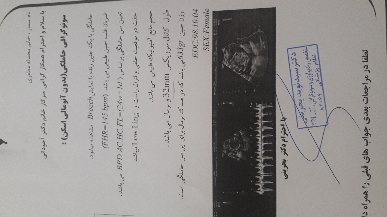 سلام ۲۴ هفته هستم سونو دادم سلام ۲۴ هفته هستم سونو دادم