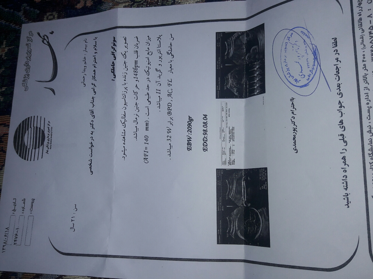 کم بودن سن جنین در سونوگرافی