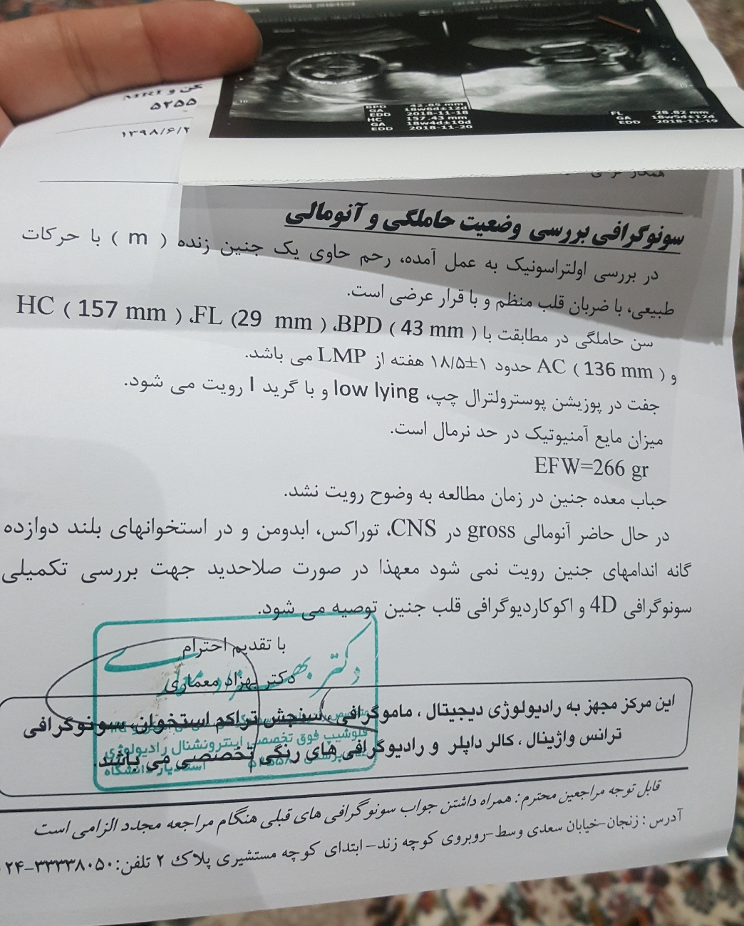 تفسیر سونو آنومالی