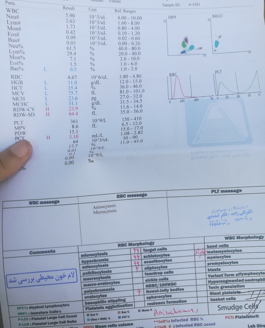 تفسیر ازمایش خون cbc