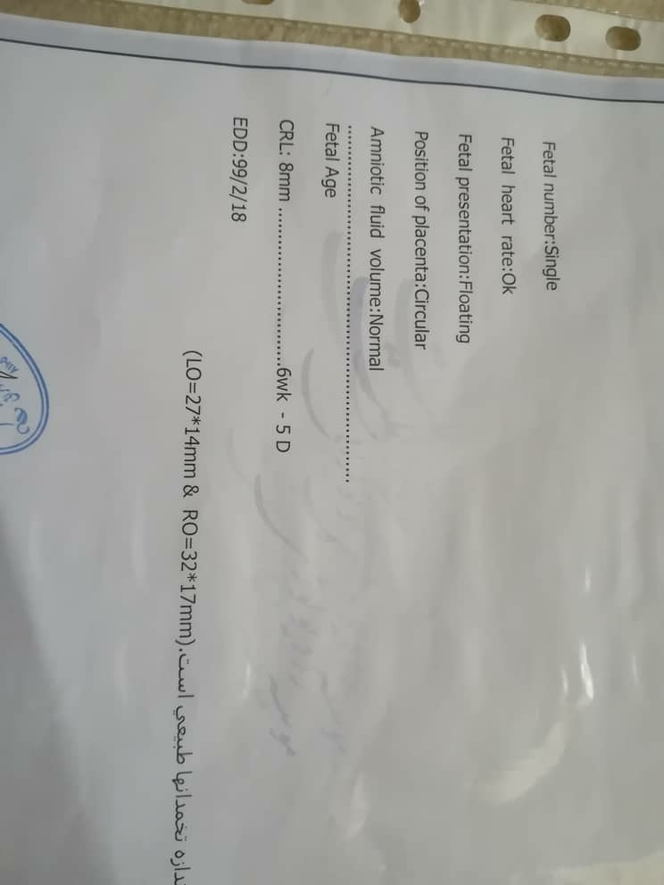 سونو گرافی تشکیل قلب سونو گرافی تشکیل قلب