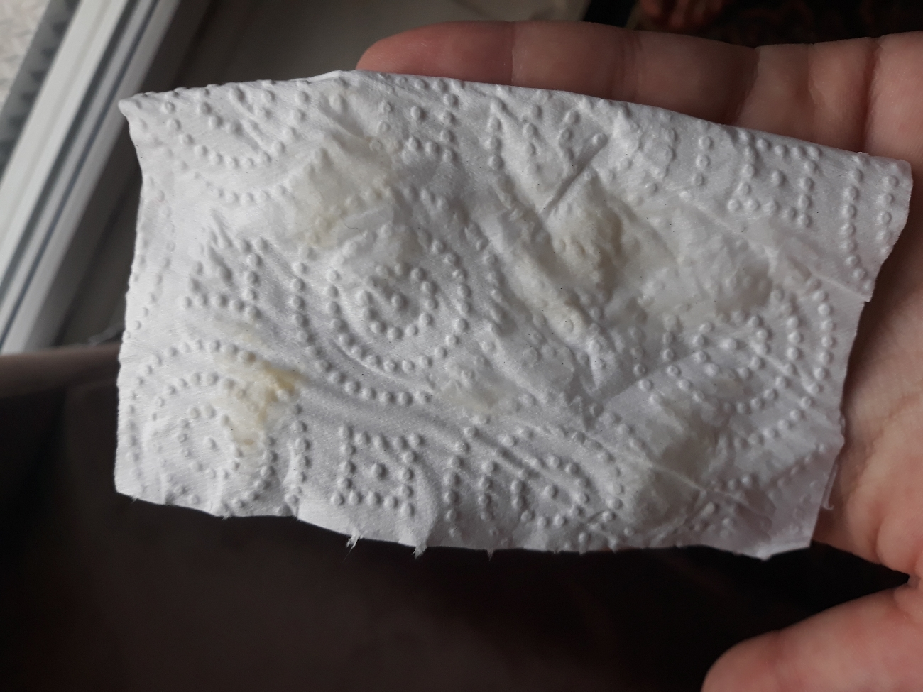 سونو و ندیدن ضربان سونو و ندیدن ضربان