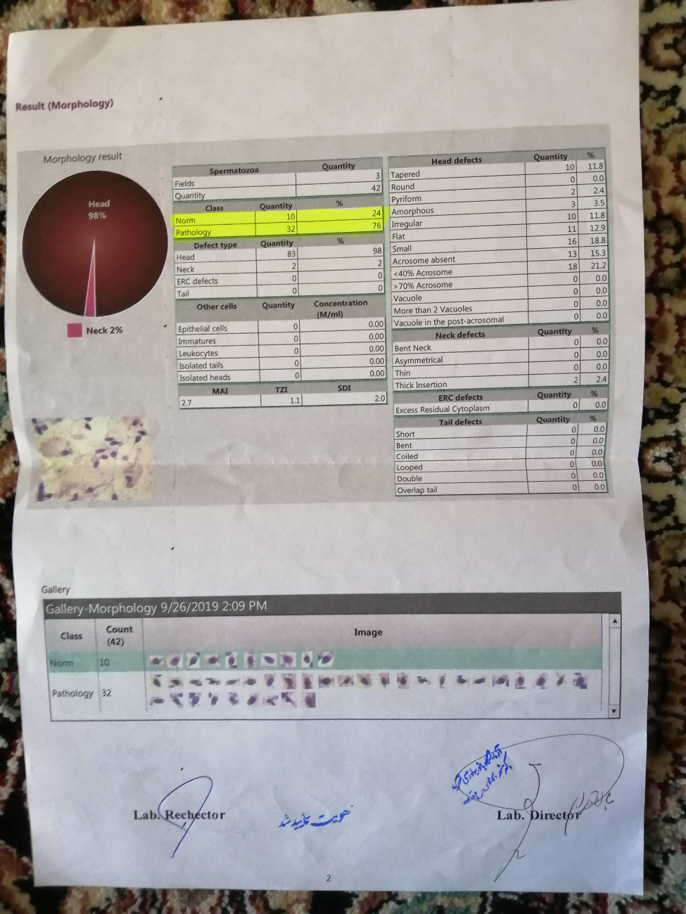 تفسیر انالیز اسپرم همسرم