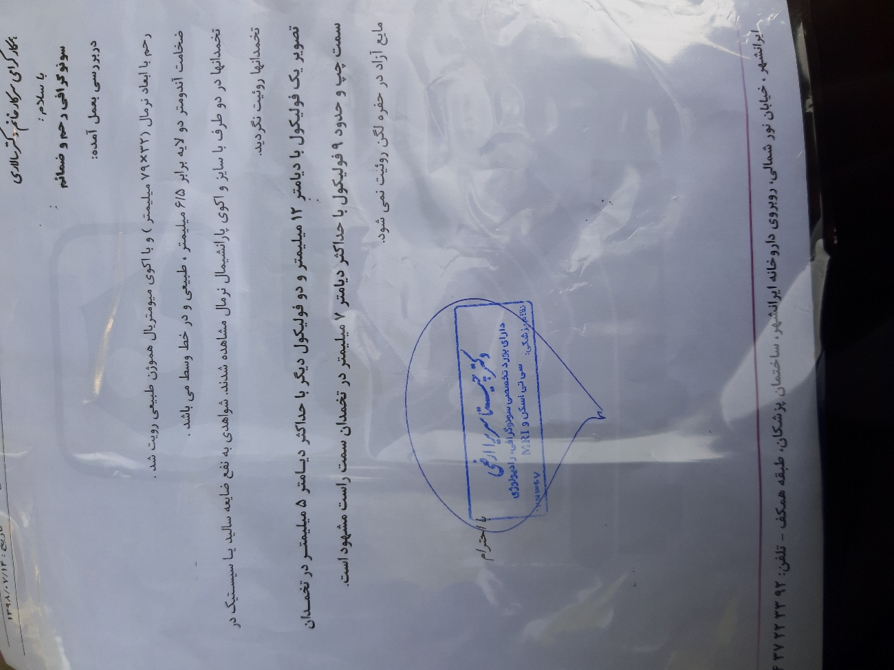 قرص اندانیل انداسترون و عوارض