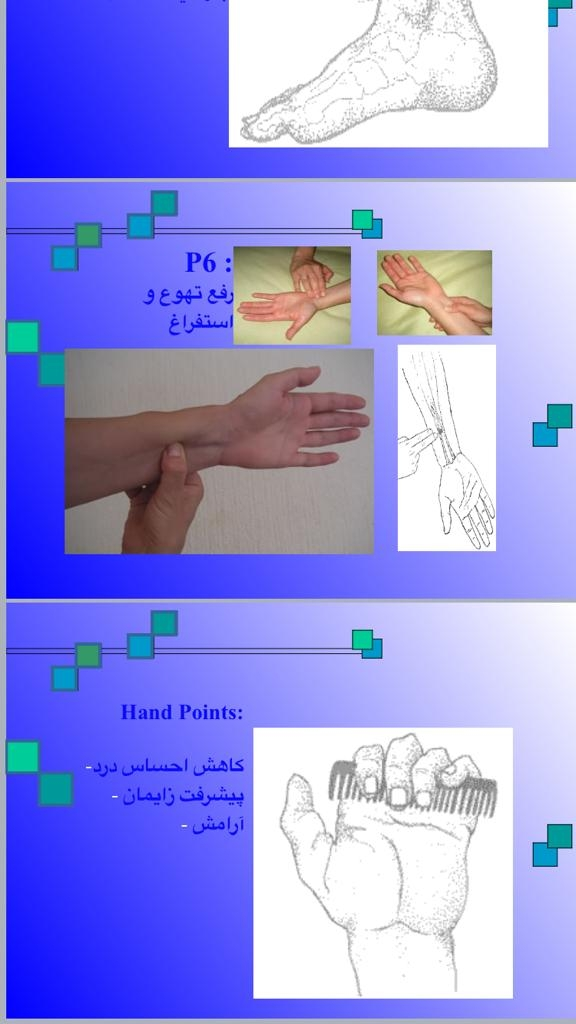 شروع شدن درد زایمان طبیعی شروع شدن درد زایمان طبیعی