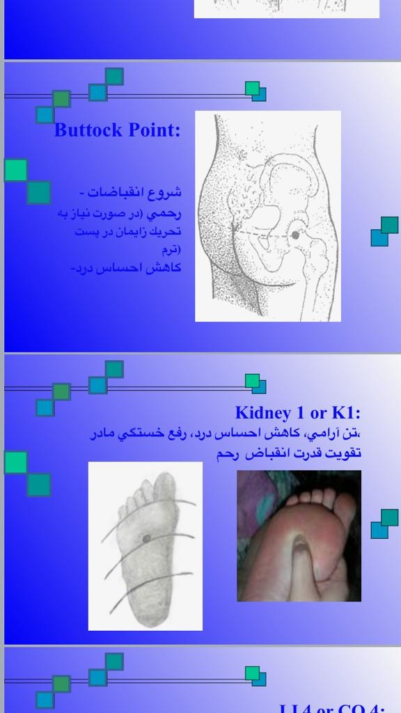 شروع شدن درد زایمان طبیعی شروع شدن درد زایمان طبیعی