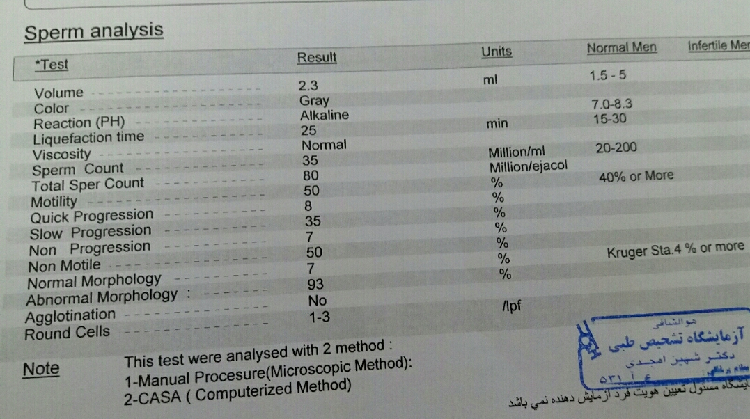 تفسیر آزمایش اسپرم همسرم