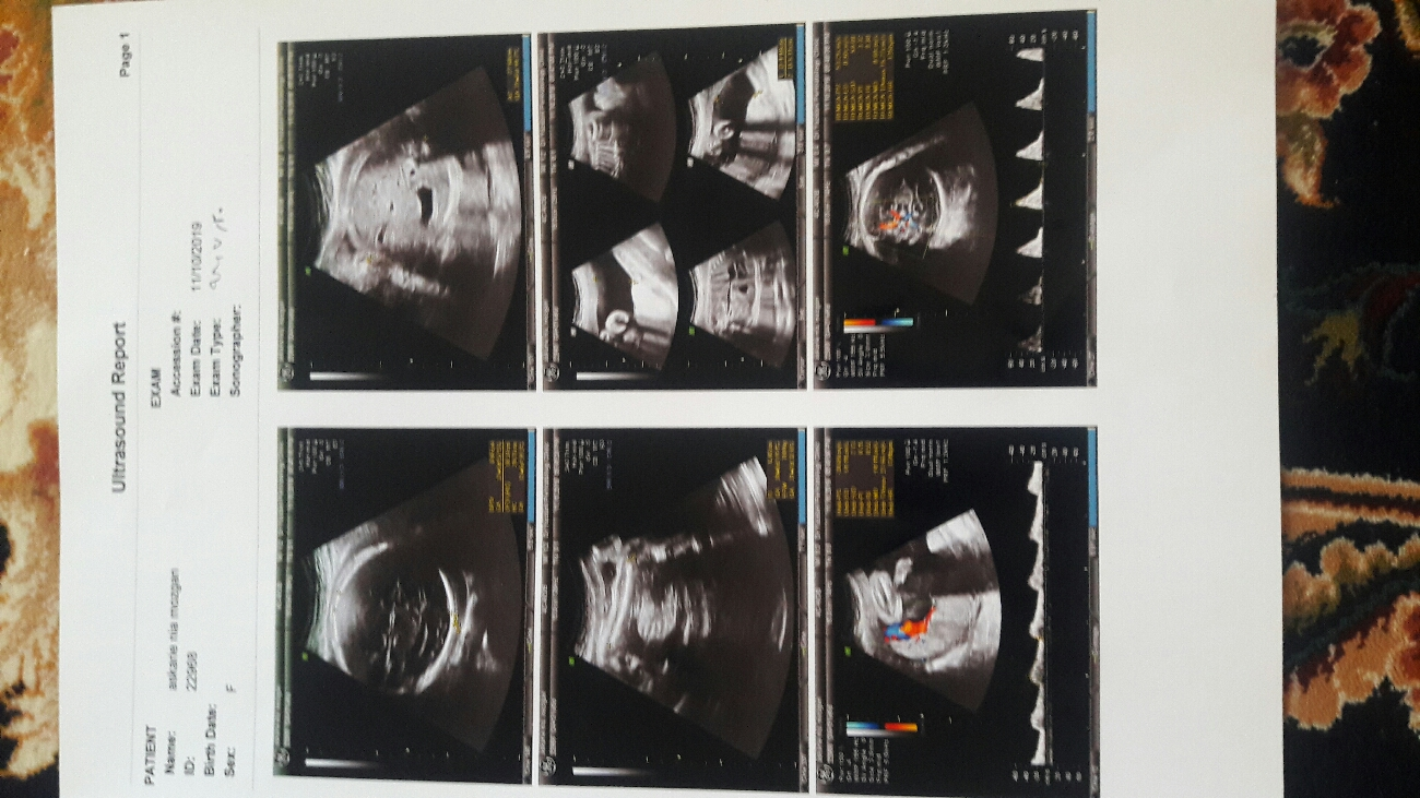 تفسیر سنو گرافی رشد و چند سوال دیگه خدمت پزشک محترم تفسیر سنو گرافی رشد و چند سوال دیگه خدمت پزشک محترم