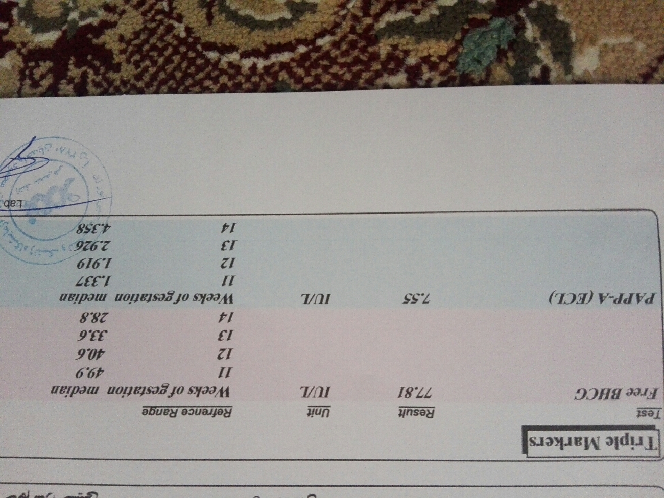 تفسیر ازمایش ان تی و غربالگری