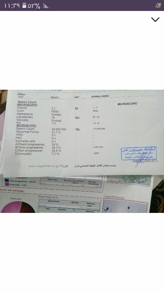 تفسیر ازمایش اسپرم همسر