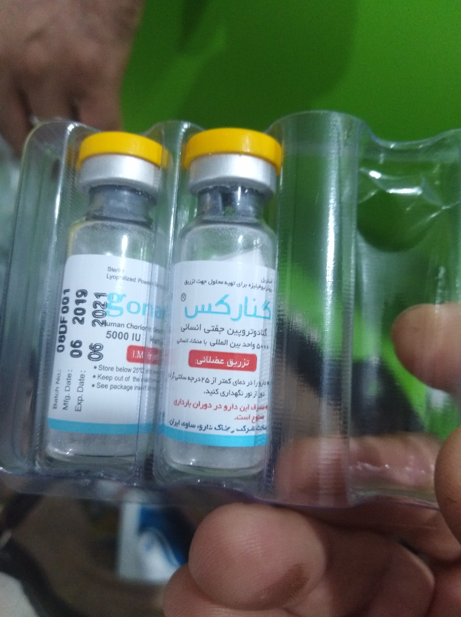 عقب افتادن پریود منظم و بی بی چک منفی