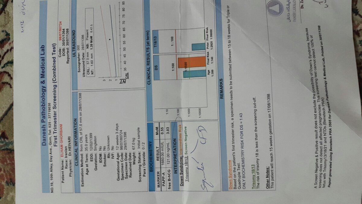 تفسیر غربالگری مرحله اول و تشخیص سندرم داون ؟