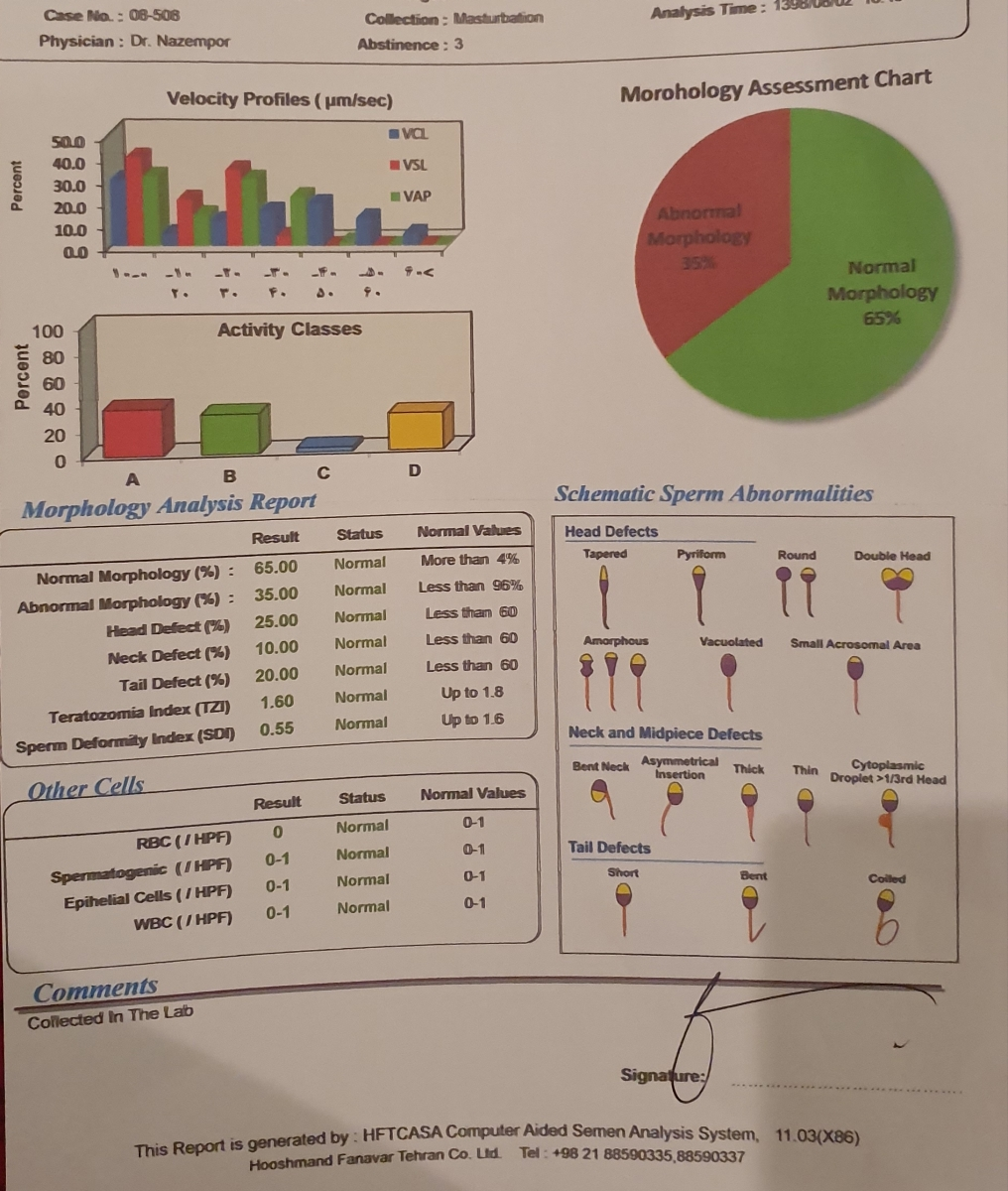 نتیجه آزمایش اسپرم همسرم