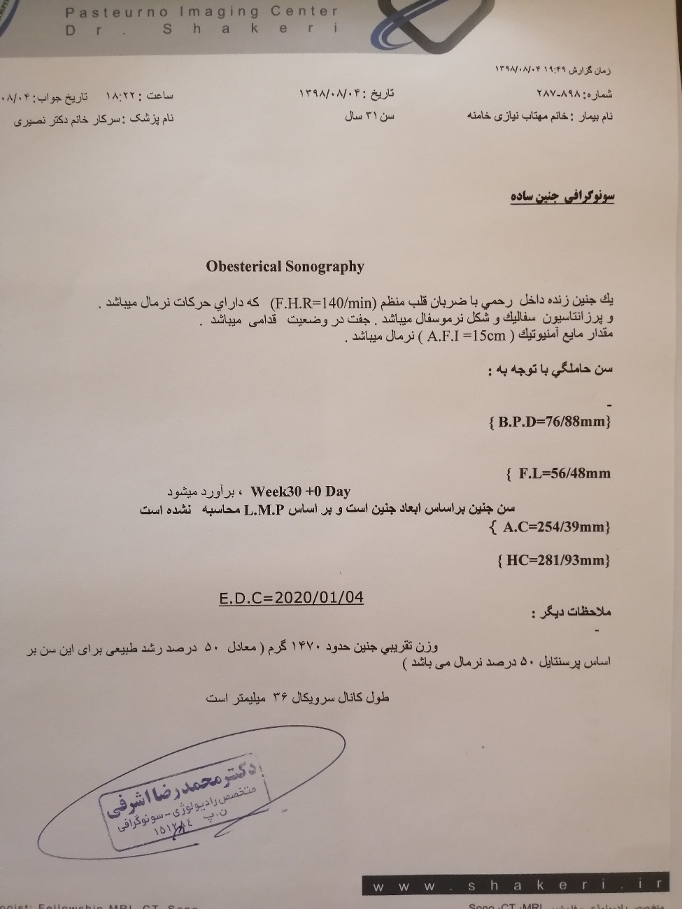 میزانaflدر سونوگرافی داپلر هفته 29 میزانaflدر سونوگرافی داپلر هفته 29
