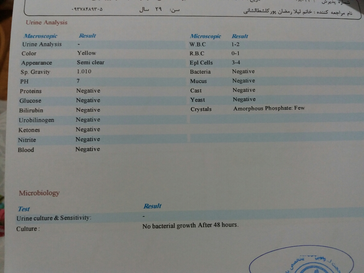 تقصیر آزمایش هفته ۱۳انجام دادم