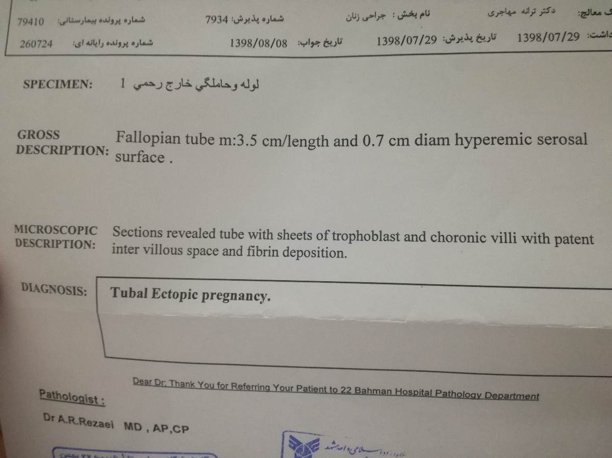 جواب آزمایش بارداری خارج از رحم