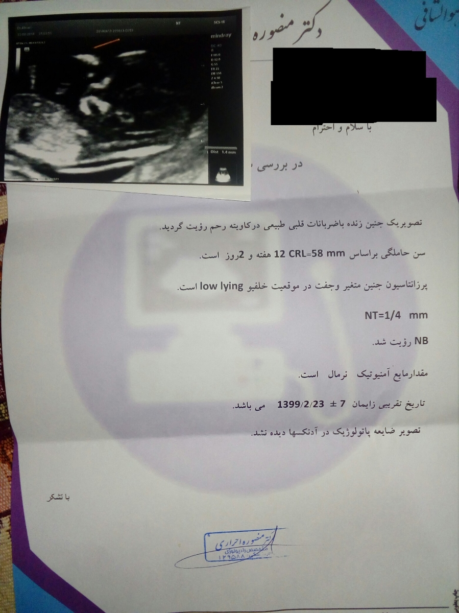 تفسیر سونو گرافی ان تی تفسیر سونو گرافی ان تی