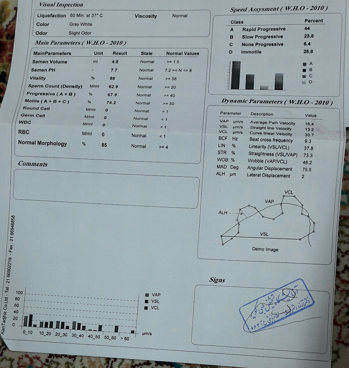 تفسیر و جواب ازمایش اسپرم