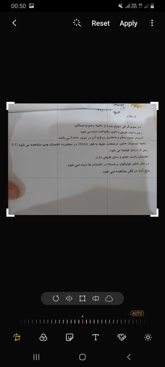 رفع کیست و اقدام به بارداری