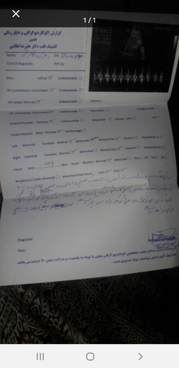 تعیین ماه باراری و هفته