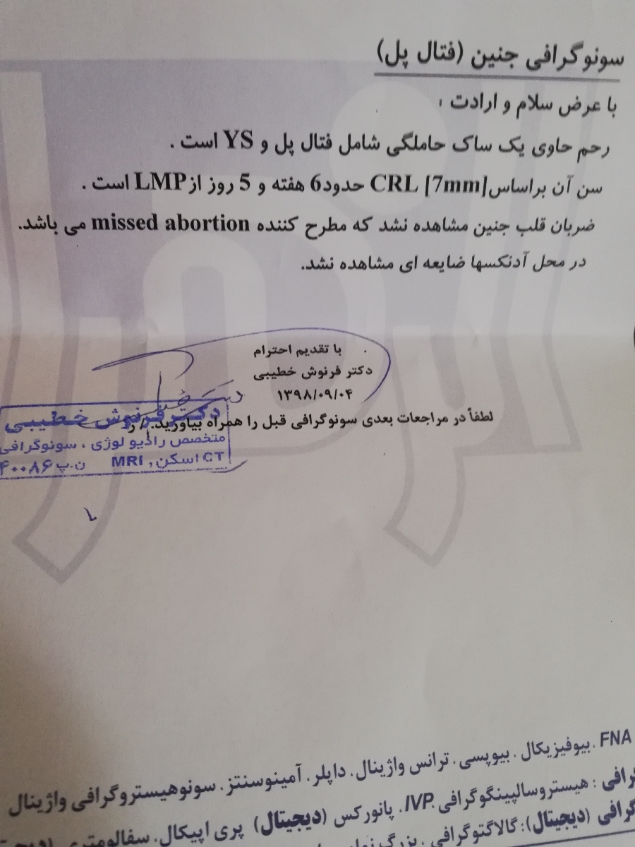 شش هفته و سه روز و تشکیل نشدن قلب شش هفته و سه روز و تشکیل نشدن قلب