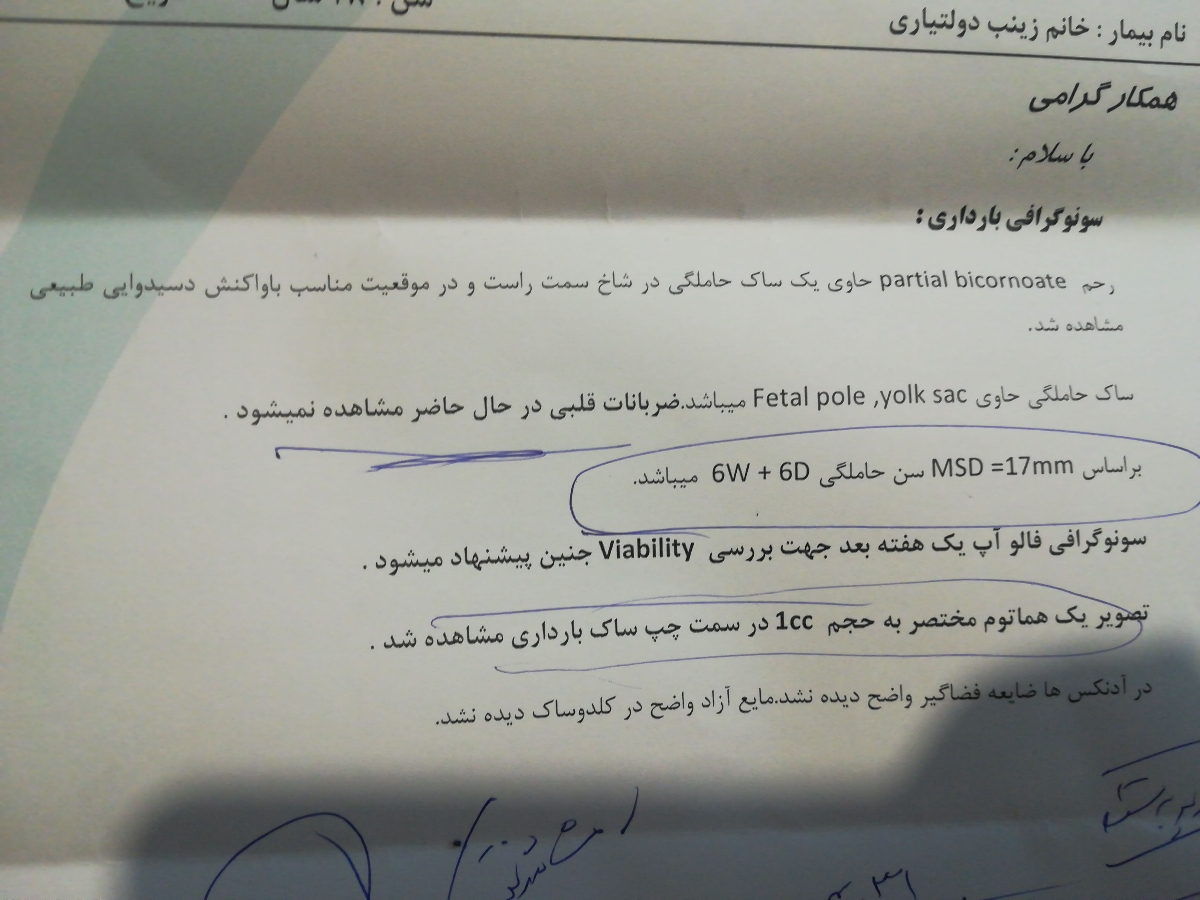 شش هفته و سه روز و تشکیل نشدن قلب شش هفته و سه روز و تشکیل نشدن قلب