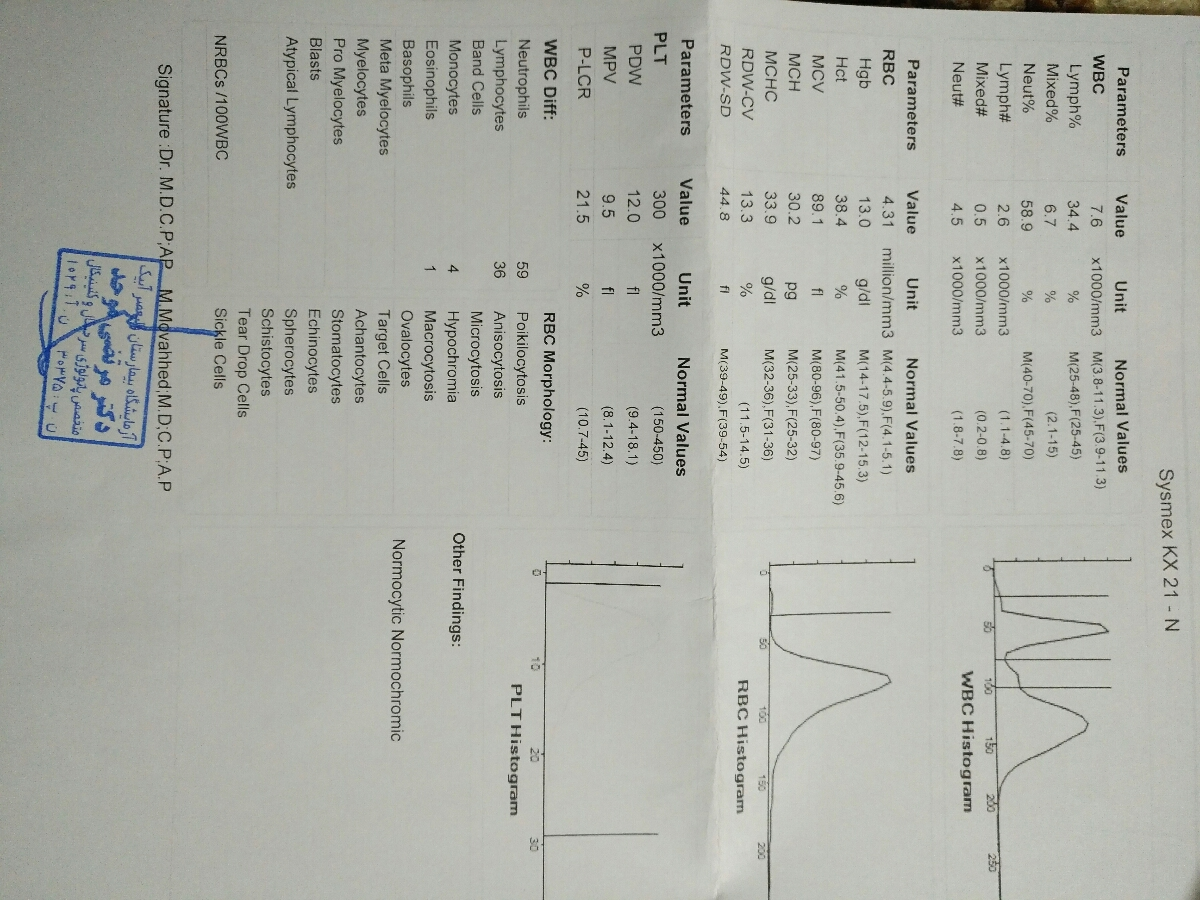 تفسیر ازمایش انومالی