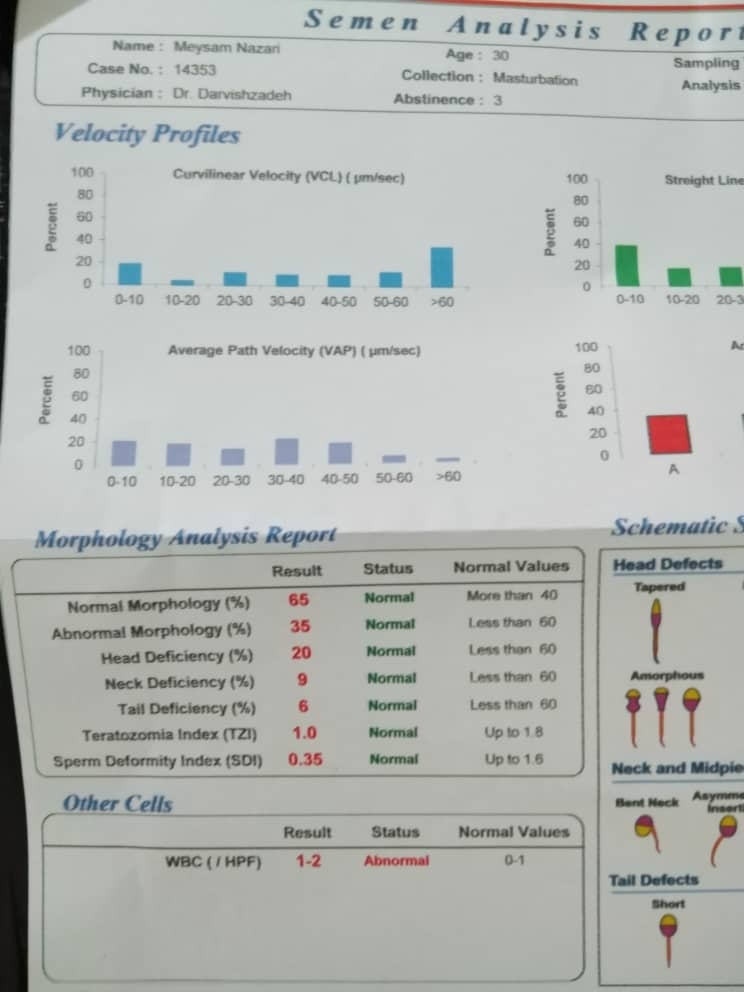 جواب آزمایش اسپرم همسرم چطور هستش