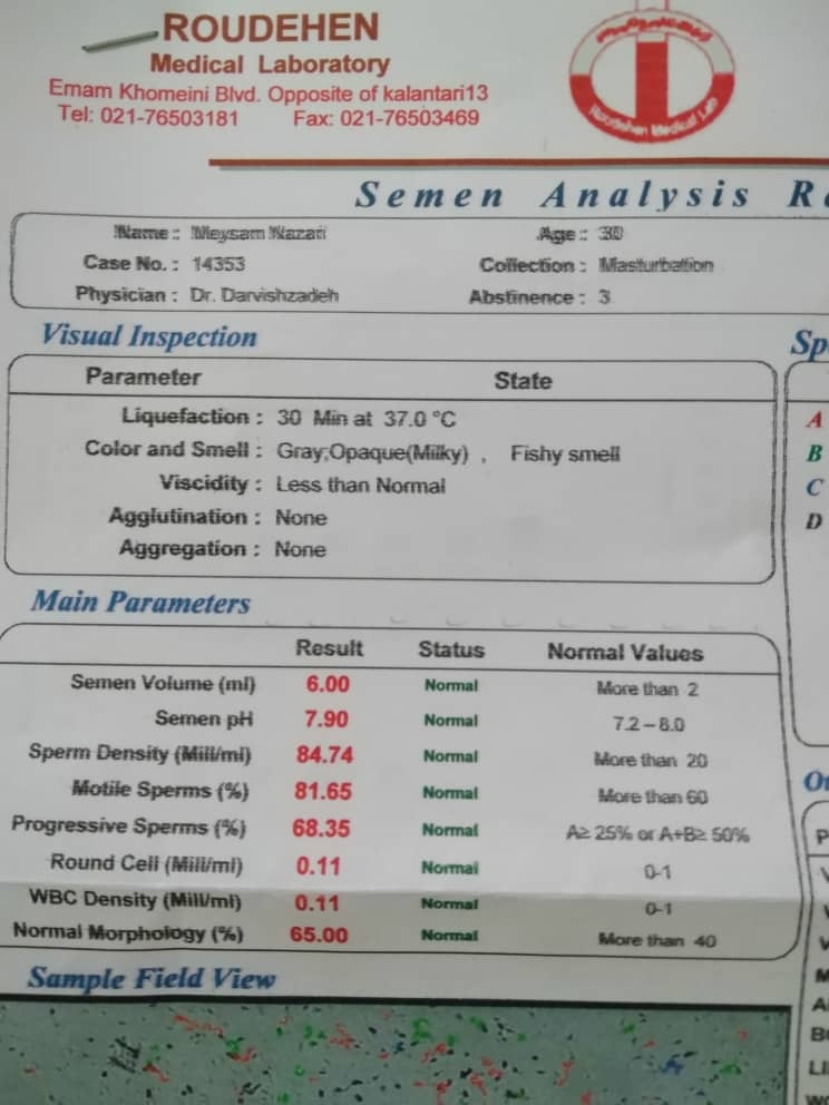 جواب آزمایش اسپرم همسرم چطور هستش
