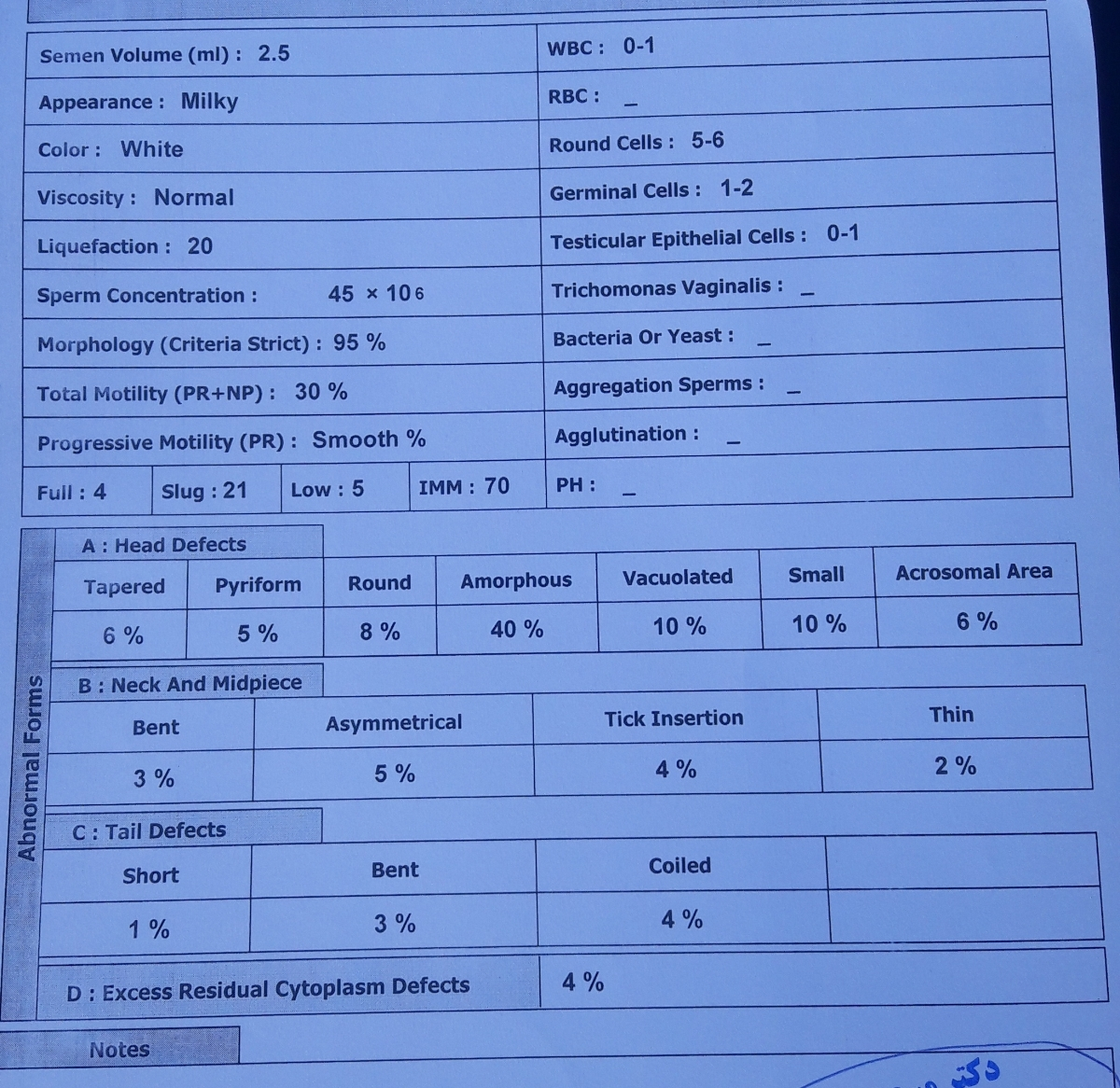 تفسیر ازمایش SA شوهرم