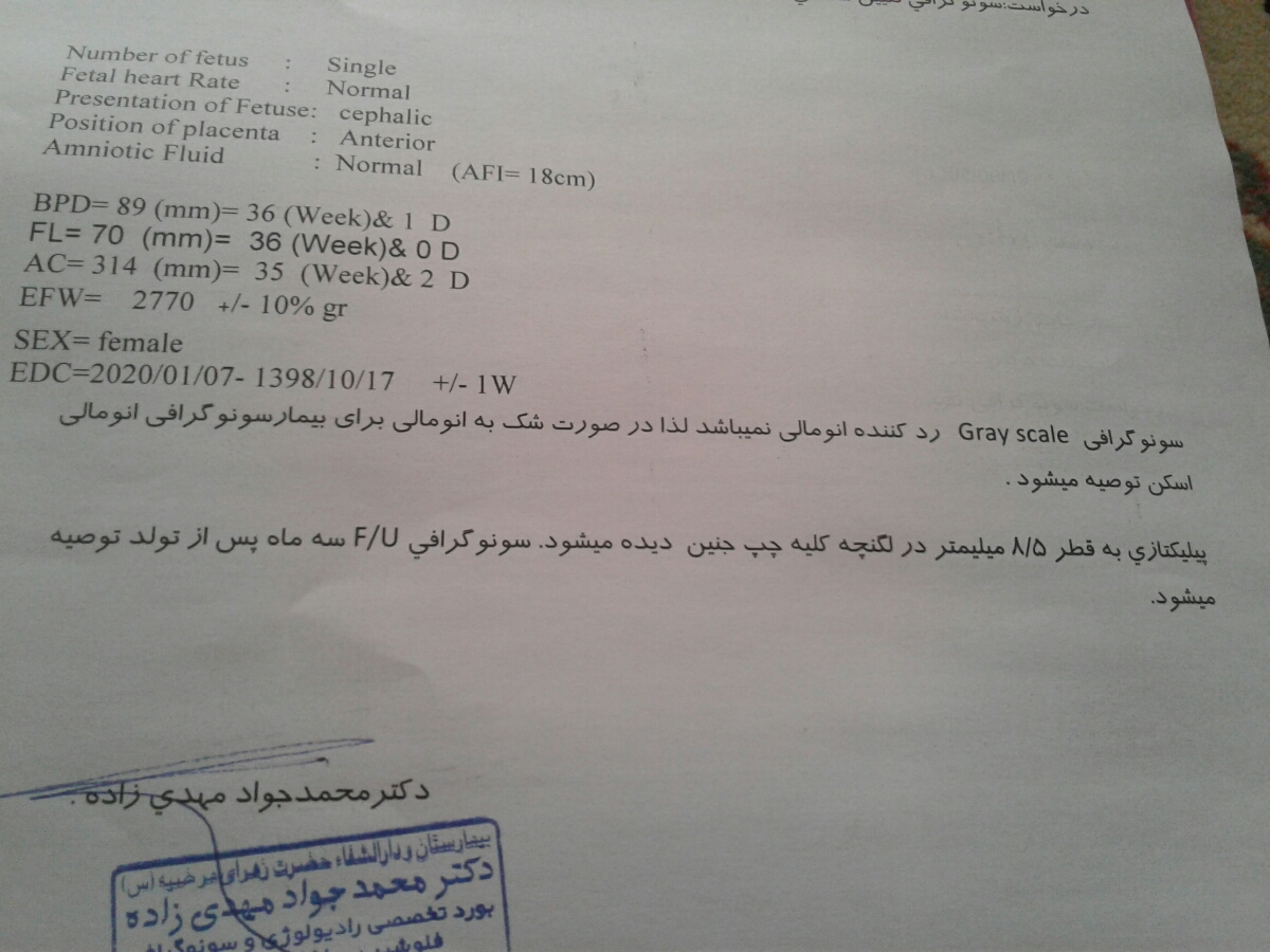 مشاهده پیلیکتازی در لگنچه کلیه جنین در هفته 36 مشاهده پیلیکتازی در لگنچه کلیه جنین در هفته 36