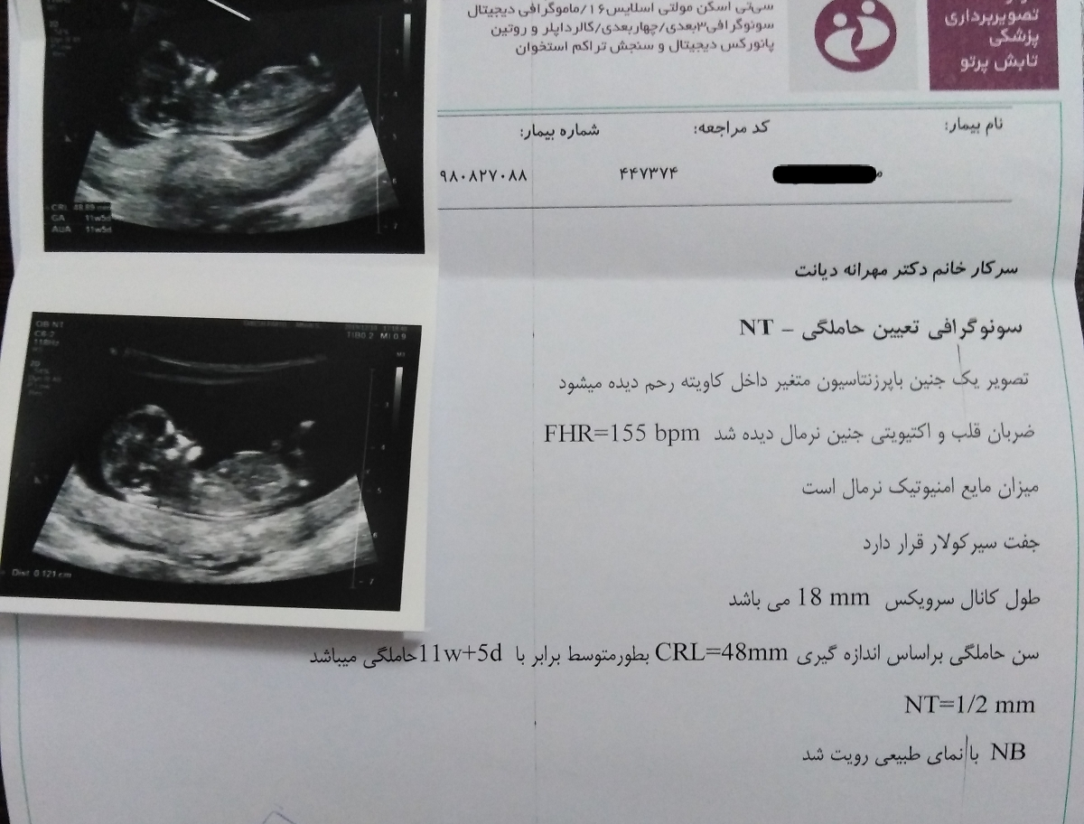 تفسیر سونو غربالگری مرحله اول تفسیر سونو غربالگری مرحله اول