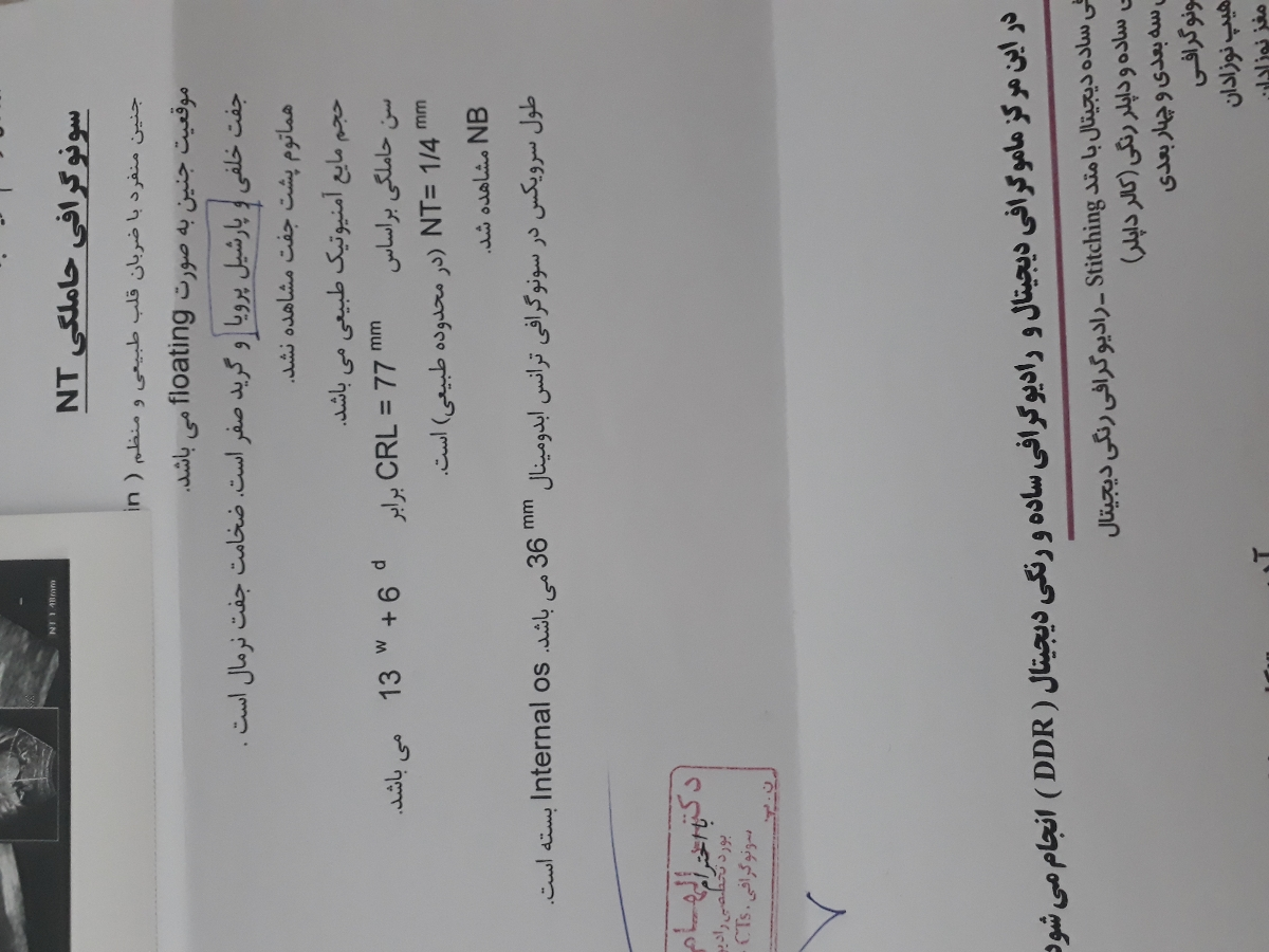 تفسیر سونو غربالگری مرحله اول تفسیر سونو غربالگری مرحله اول