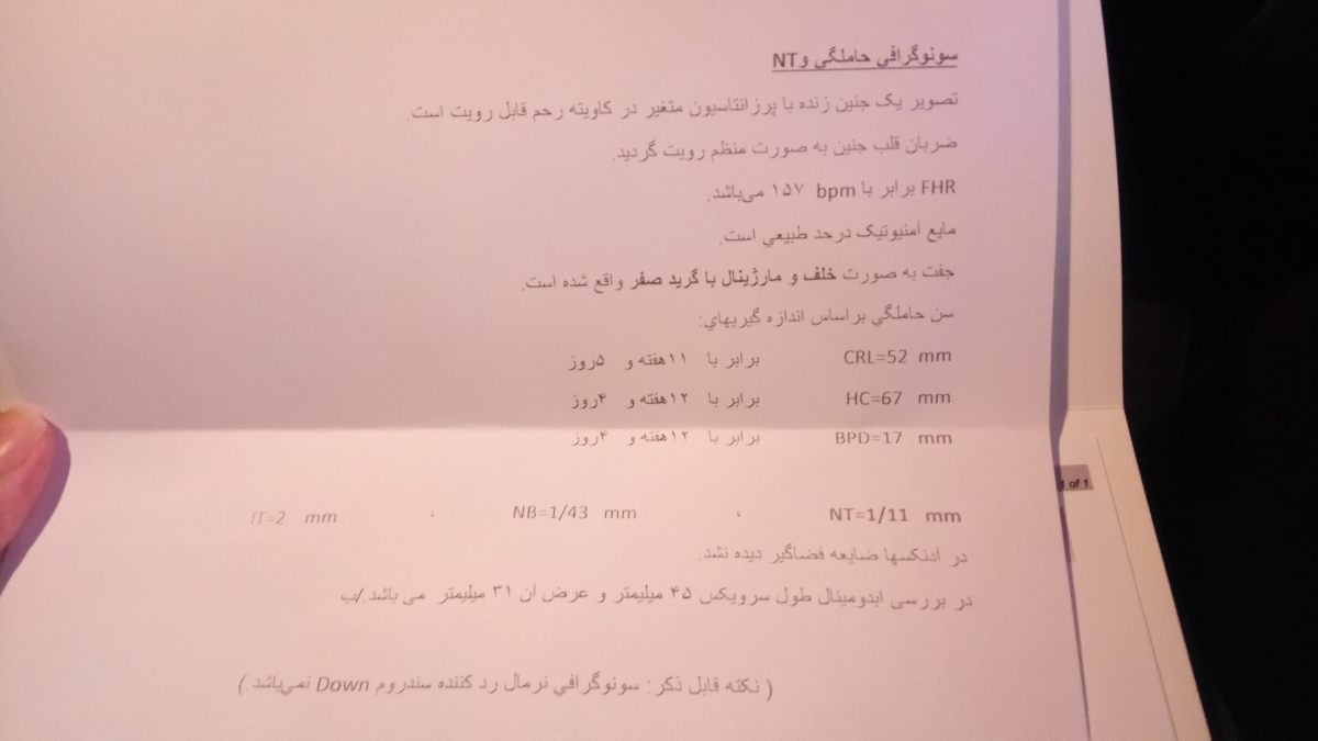 سلام دوستان آزمایش غربالگری اولمو ببینید... خیلی استرس گرفتم😭😭😭 سلام دوستان آزمایش غربالگری اولمو ببینید... خیلی استرس گرفتم😭😭😭