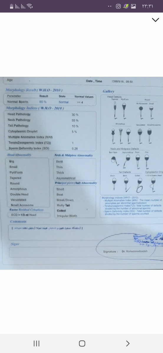 تفسیر سونو و تشخیص واریکوسل