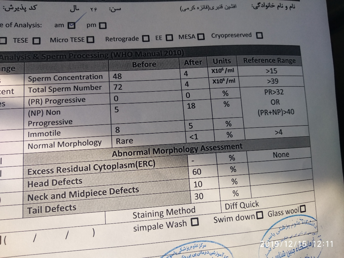 توروخدا ازمایش اسپرم شوهرمو اگ میدونین تفسیر کنین توروخدا ازمایش اسپرم شوهرمو اگ میدونین تفسیر کنین