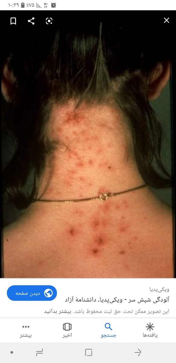 میشه بگین چرا پوست سرش اینجوری میشه میشه بگین چرا پوست سرش اینجوری میشه