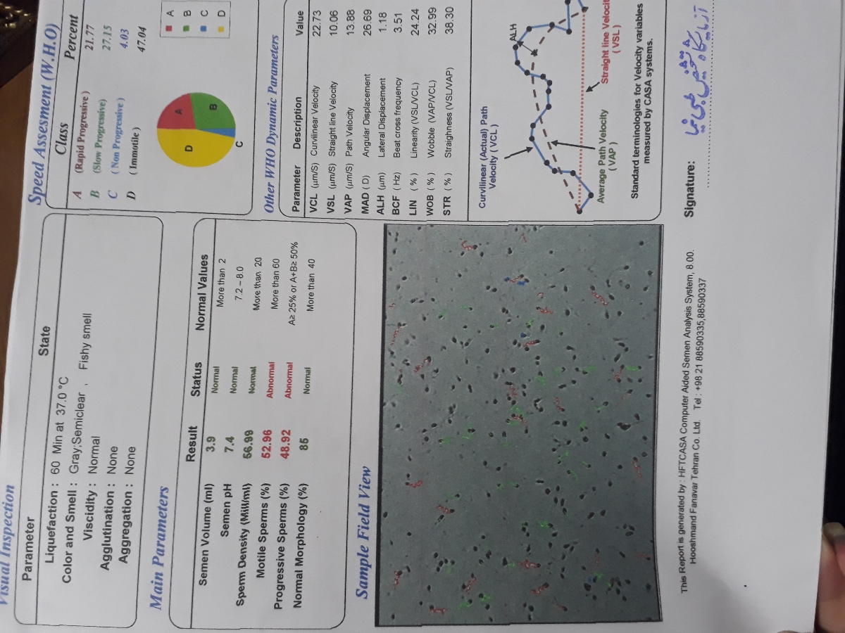 تفسیر آزمایش اسپرم همسرم