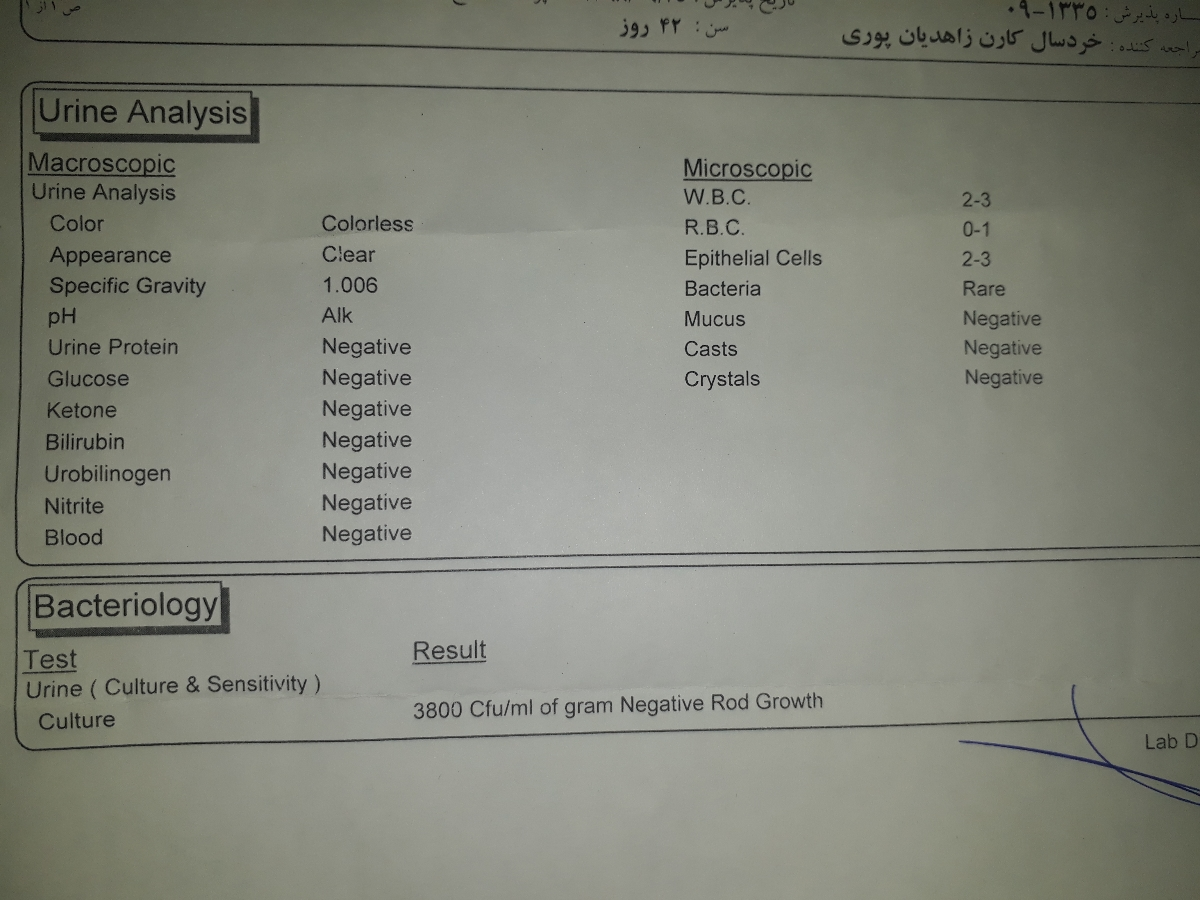 تفسیر ازمایش ادرار نوزاد!